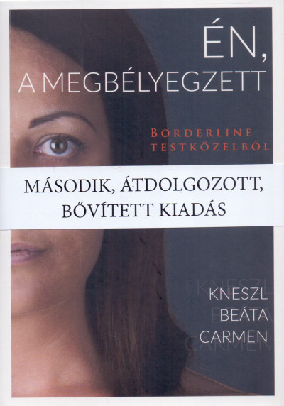 Én, a megbélyegzett